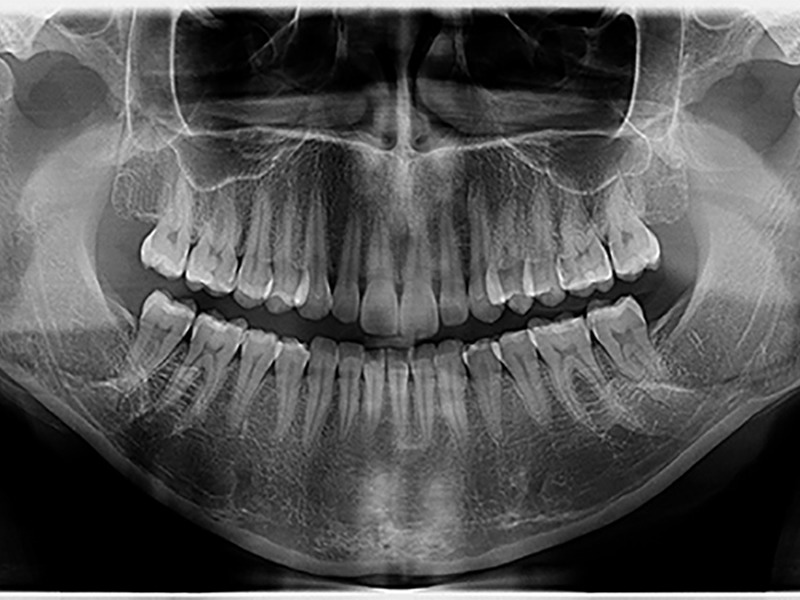 Radiografia Panorâmica