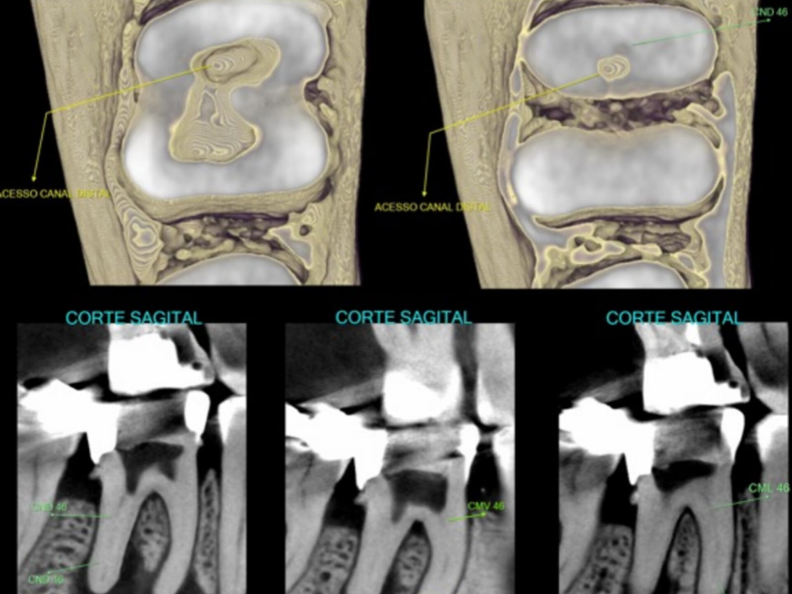 Avaliação para Endodontia - Tomograf