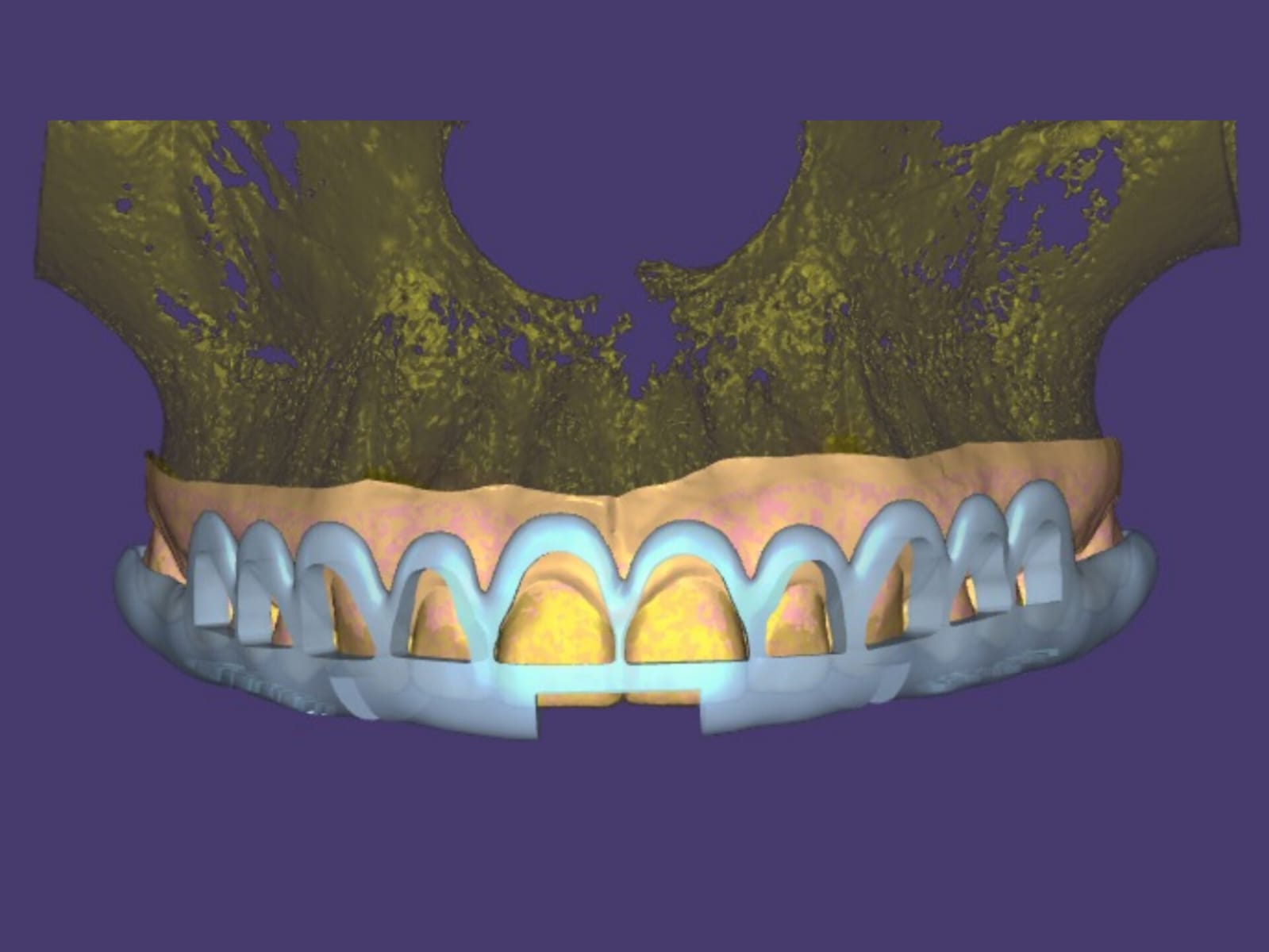 Guia Periodontal - Tomograf